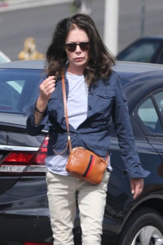 Lara Flynn Boyle unakazila se operacijama