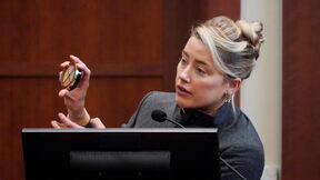 Amber Heard objasnila kako je prikrivala masnice na licu