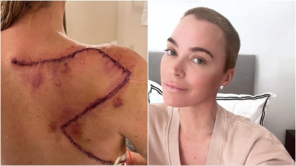 Teddi Mellencamp je teško bolesna