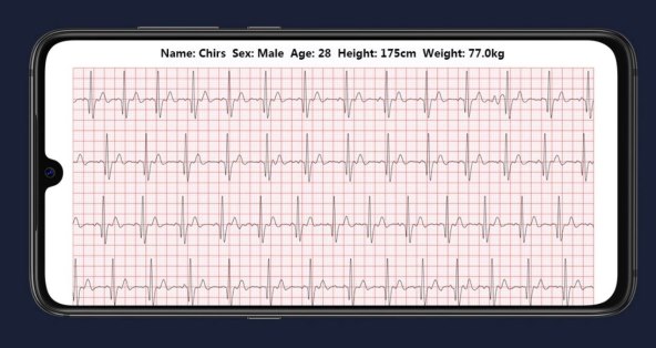 Dok se bavite sportom ova majica s EKG čipom prati otkucaje vašeg srca
