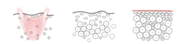 PILING LICA Čisto, nahranjeno i oblikovano lice zrači ljepotom