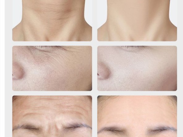 Otklonite bol, poboljšajte izgled i izgledajte mlađe