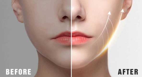 Učinite lice mlađim uz visokofrekventnu vibracijsku masažu