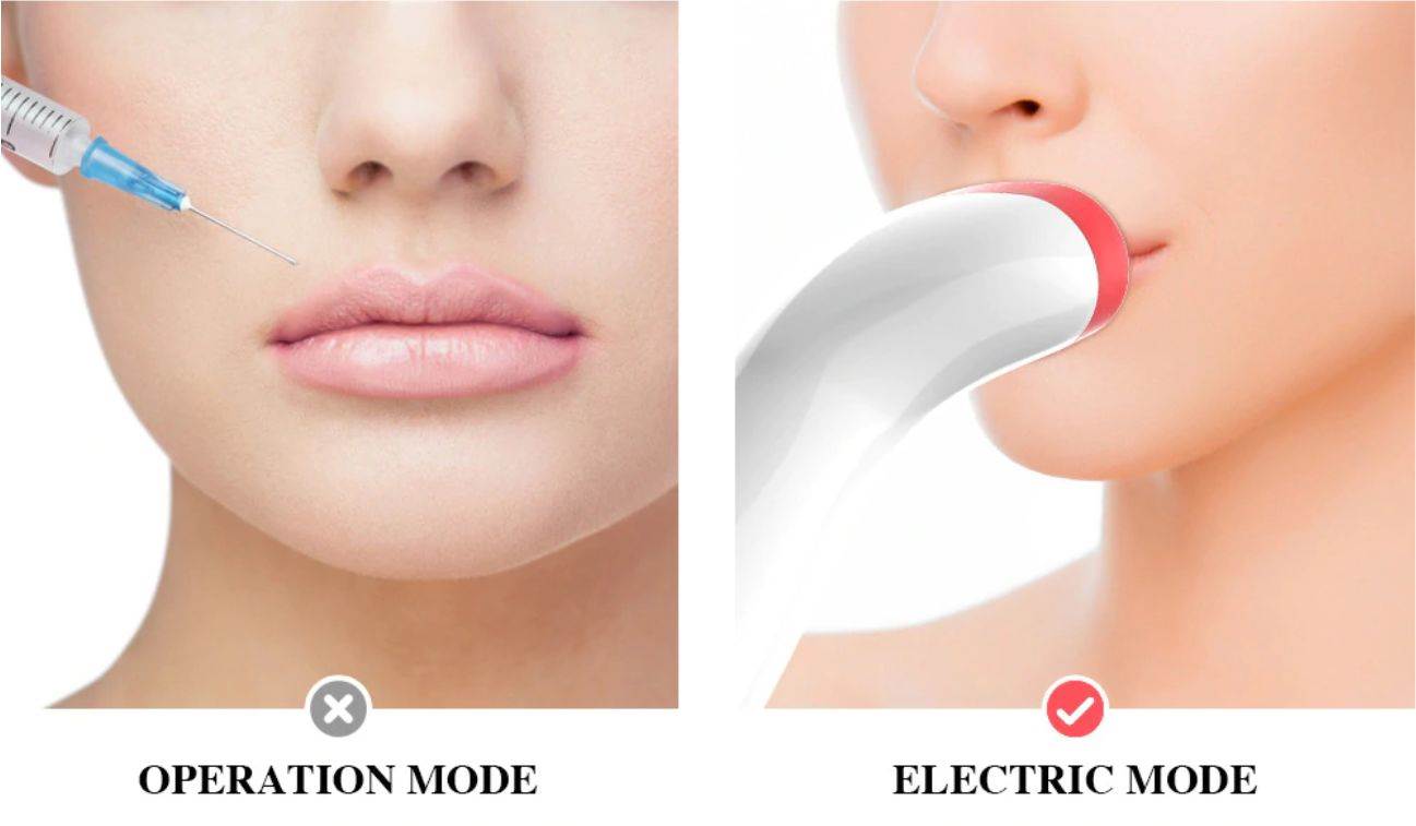 POVEĆAJTE USNE Jednostavnom metodom do super rezultata