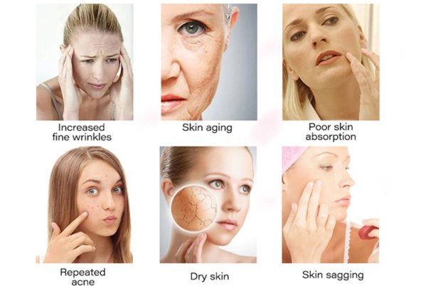 Nano crystal injektor 2