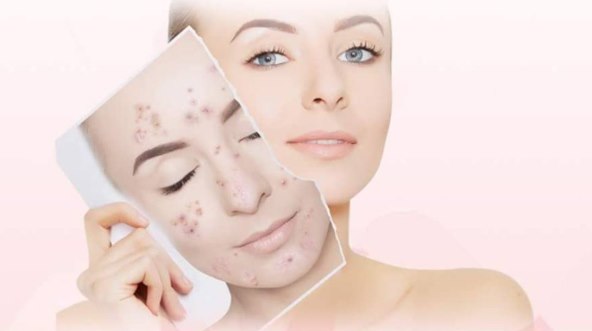 Anlan ultrazvučni piling za lice 3