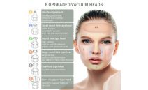 Lidofigo čistač lica 5