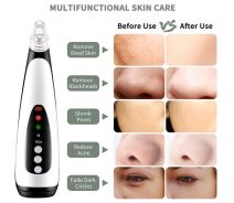 Lidofigo čistač lica 6