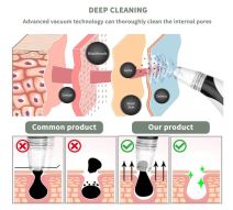 Lidofigo čistač lica 7