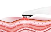 Uređaj protiv podočnjaka 5