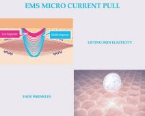 Masažer za podizanje lica 6