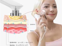 Uređaj za podizanje lica 6.jpg