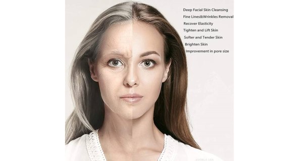 Uređaj za ljepotu lica 2.jpg