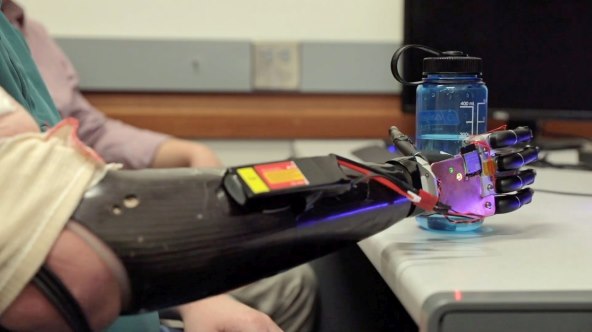 Protetska ruka (4).jpg