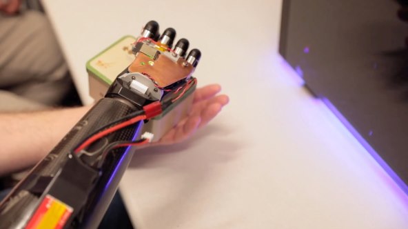 Protetska ruka (3).jpg