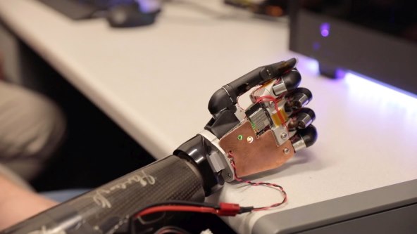 Protetska ruka (2).jpg