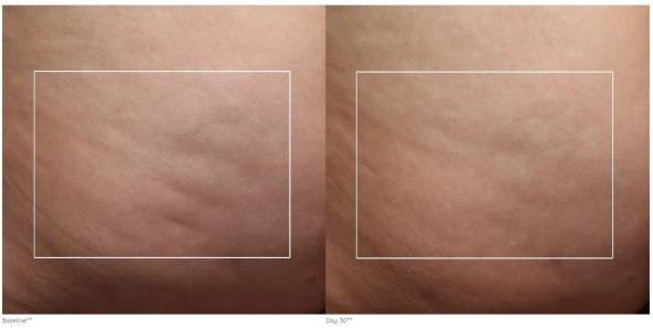 Nuface NuBody (8).jpg