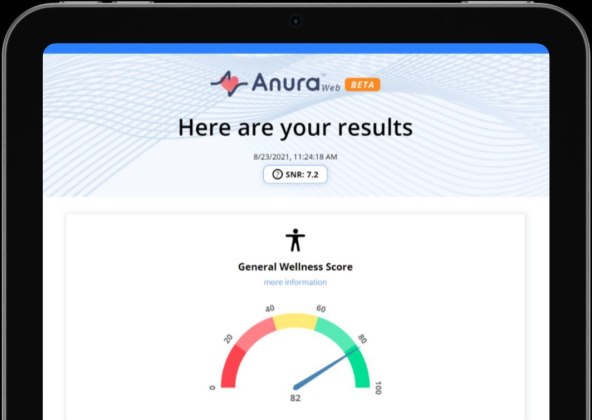 Anura Web (1).jpg