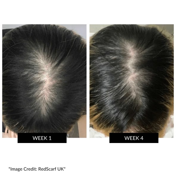 CurrentBody Skin LED Hair Regrowth Device (3).jpg