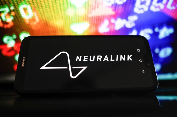 MUSK JE USPIO: Prvi čovjek s čipom u mozgu