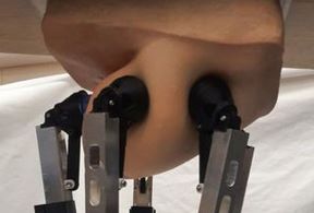 Robot otkriva rak dojke (5).jpg