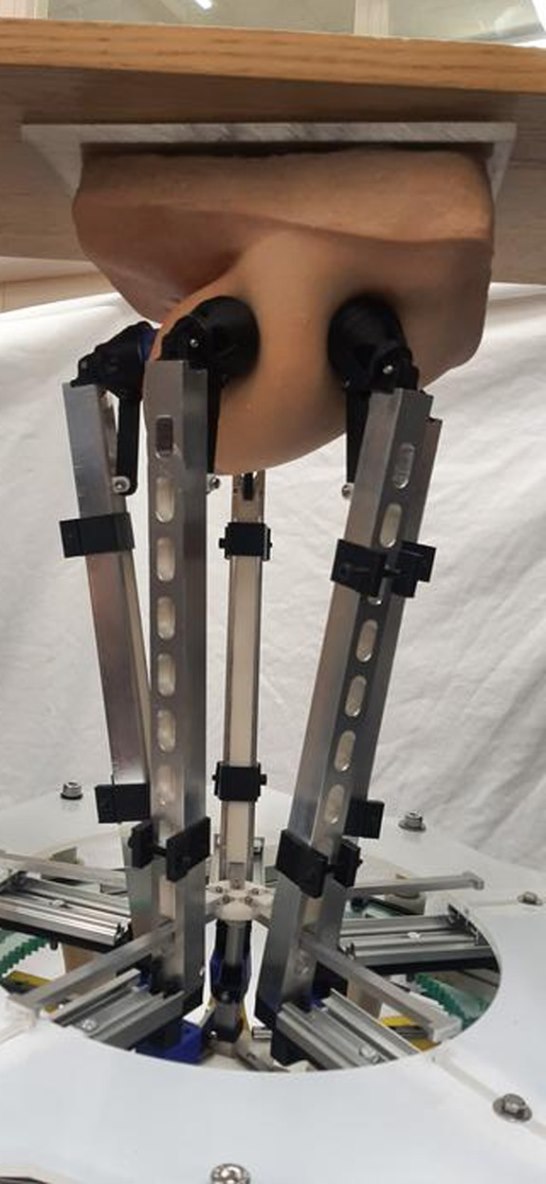 Robot otkriva rak dojke (4).jpg