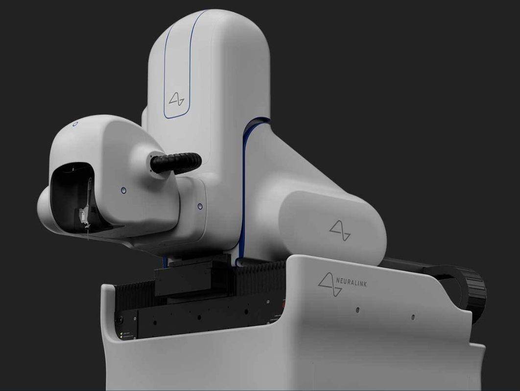 Neuralink ugradnja čipa u mozak (2).jpg