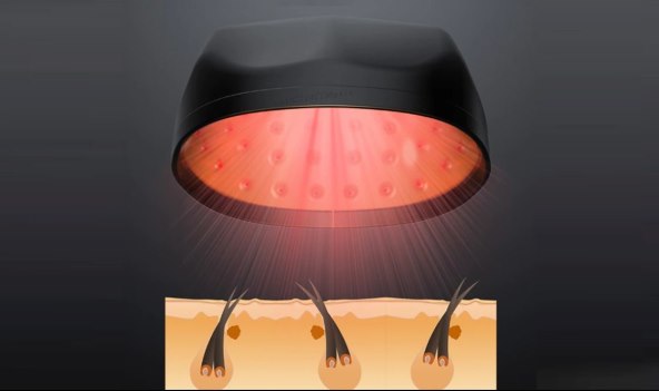 KACIGA S LASERSKOM TERAPIJOM Kosa će vam biti kvalitetnija i brže rasti