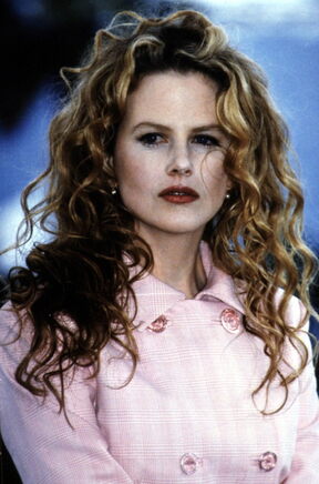 Nicole Kidman zbog plastičnih operacija ima mišje uši