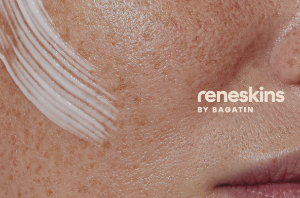 Reneskins članak slika 1.png