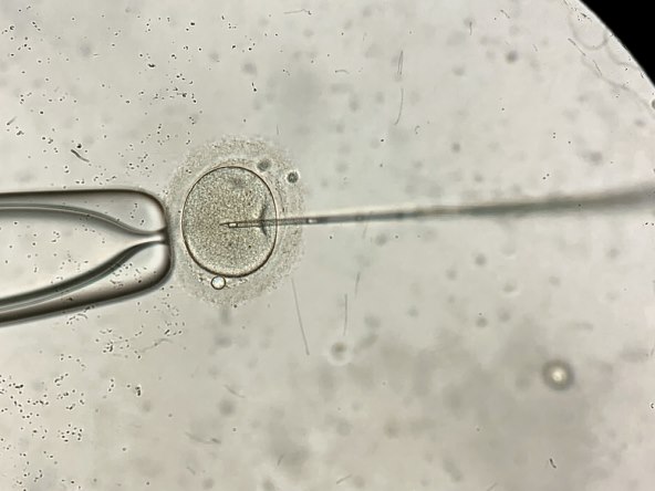 315-fertilizacija-in-vitro-najvaznija-pitanja-i-odgovori