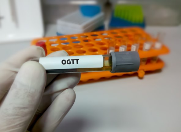 ogtt i trudnicki dijabetes