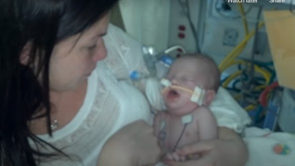 Beba koja je umrla od gladi