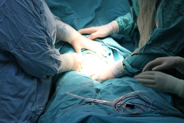 8 stvari koje nisam znala prije carskog reza