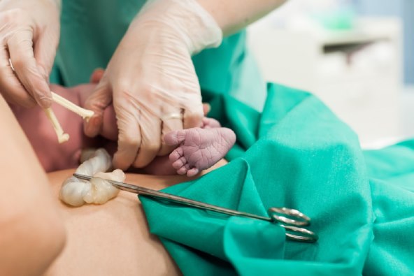 Porođaj nekad i danas - promjene u carskom rezu, epiduralnoj, epiziotomiji