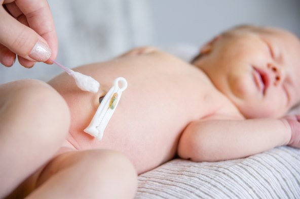 bataljak i njega pupka kod bebe, što napraviti kada dode u dodir s urinom?