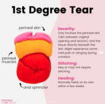 Kako izgleda rezanje pri porodu