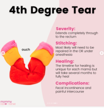 Kako izgleda rezanje pri porodu