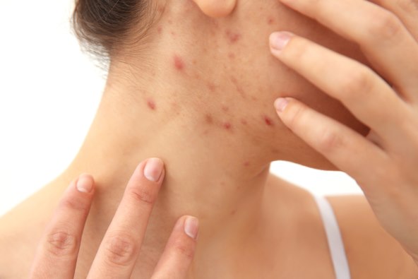 34 neobicna simptoma trudnoce