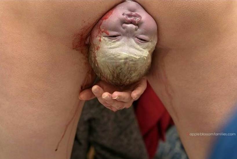 Stvarne fotografije s poroda