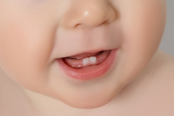 Kojim redoslijedom rastu zubi i kako ublažiti bol?
