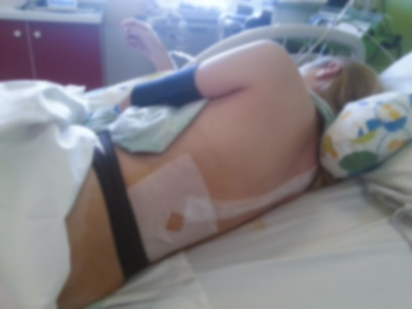 Loše iskustvo mame s carskim rezom u rodilištu Merkur u Zagrebu