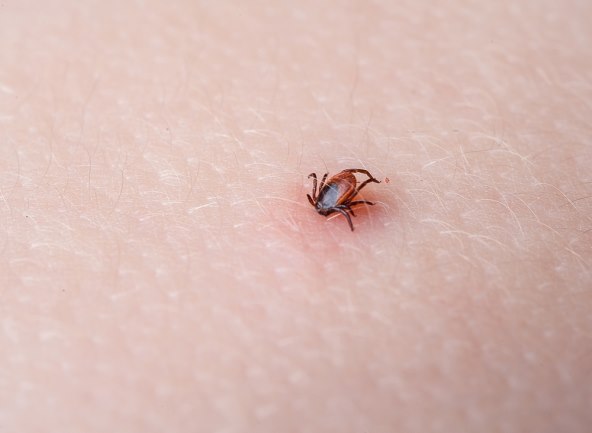 kako izvaditi krpelja i sprijeciti pojavu infekcije