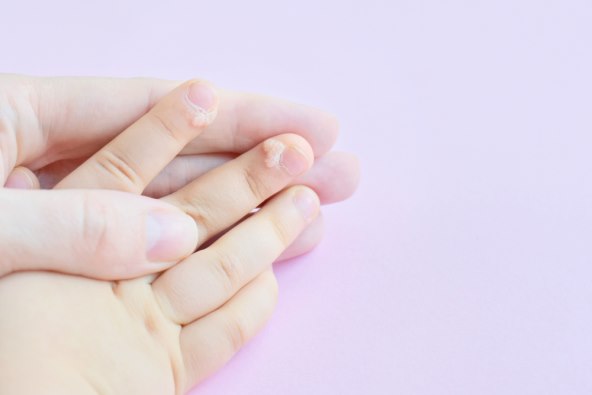 Koje su najcešca kožna stanja i bolesti kod djece?