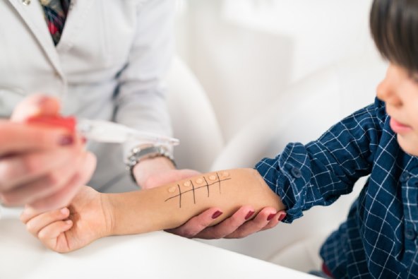 Pedijatar o najcešcim alergijama kod djece, alergeni, simptomi i lijecenje