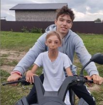  Kako danas izgleda djevojcica rodena bez pola lica?