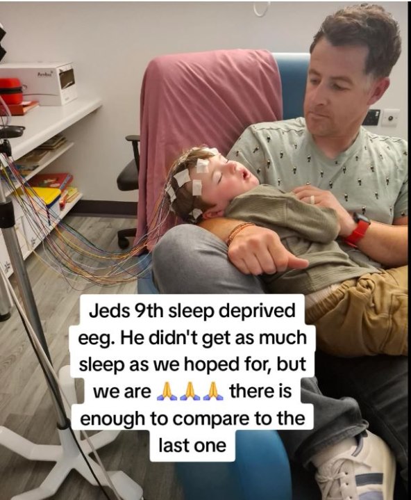 Djecak pretrpio oštecenja mozga zbog virusa herpes