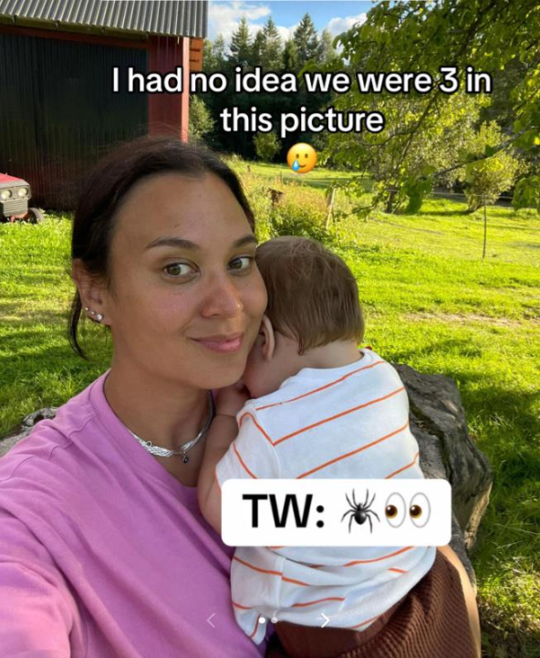 Bebi se krpelj zalijepio za trepavice