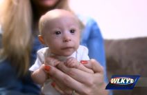 Patuljasti rast kod beba