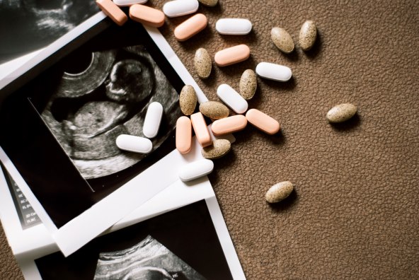 svaka 5. žena ce nakon umjetne oplodnje ostati trudna prirodnim putem kao i Nevena Rendeli